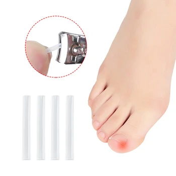plasture pentru îndepărtarea unghiilor de la picioare